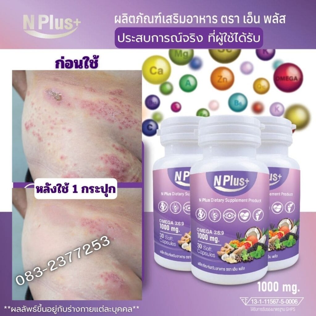 งูรี๓